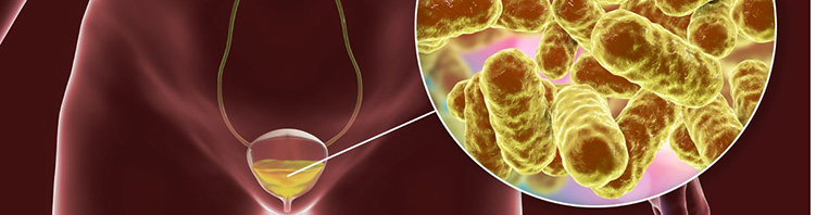 Pautas dietéticas para la cistitis